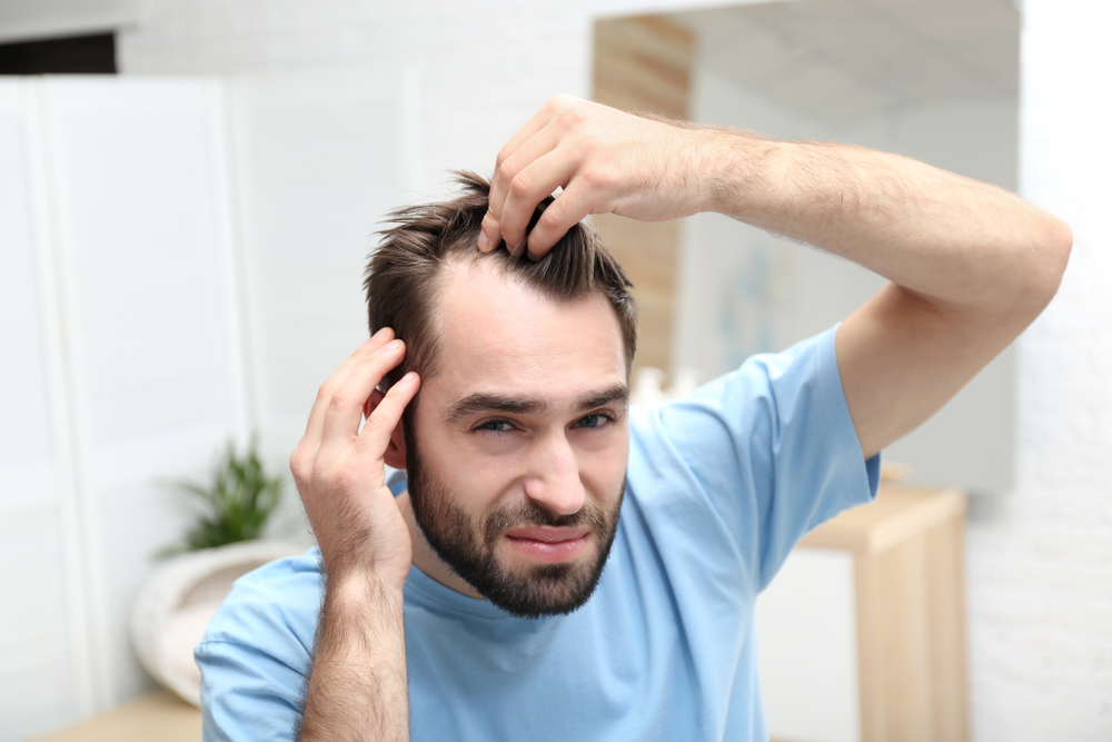 How to remove dht from scalp