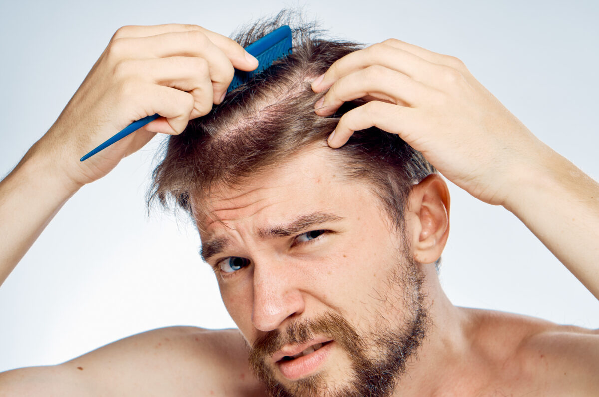 How can you tell your hair is thinning