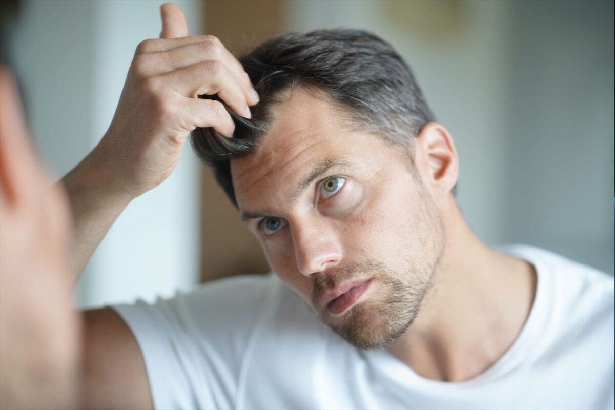 Can vitamin supplements cause hair loss