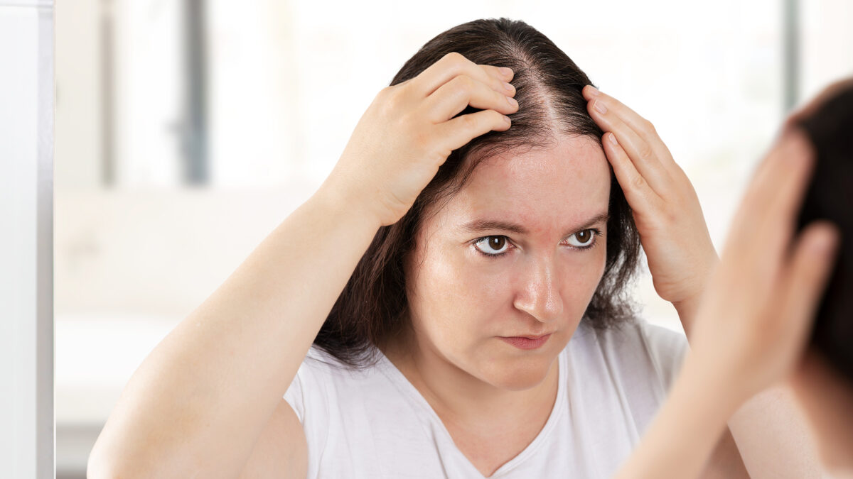 Best products for hair loss female